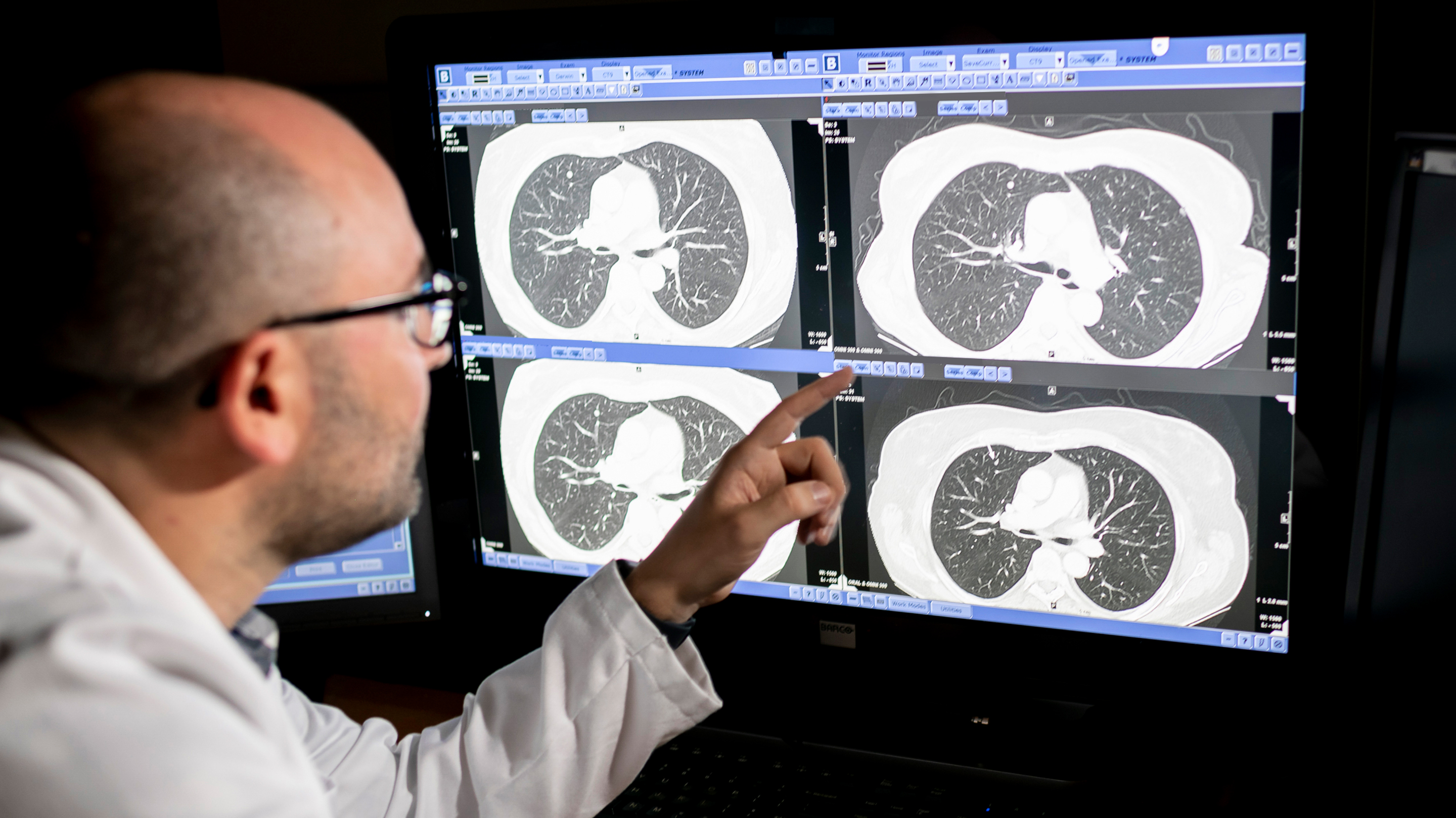 Radiologist Dr. Andrew Plodkowski reviewing a lung scan on a computer screen.