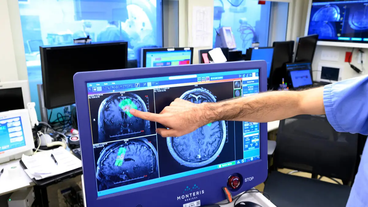 A hand points to brain images on a screen.